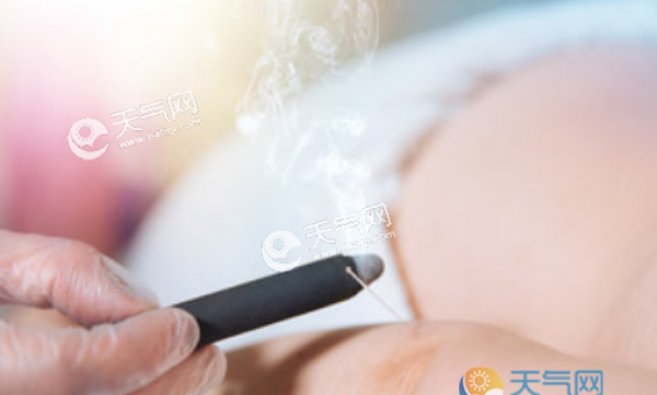 艾灸的好处与功效 三伏天艾灸的作用和禁忌必知