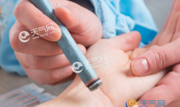 2019三伏天艾灸的好处 三伏天艾灸的四大好处