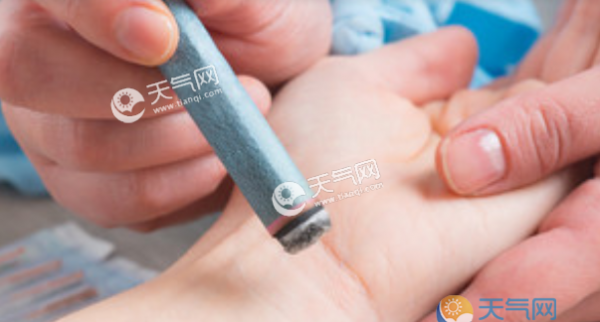 三伏天艾灸疗程 2019三伏天艾灸疗程时间安排表
