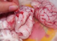 核桃瘦肉炖猪脑的做法步骤2