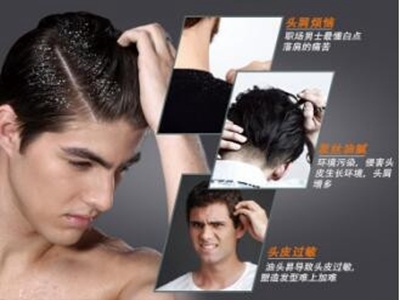 强效去油洗发水