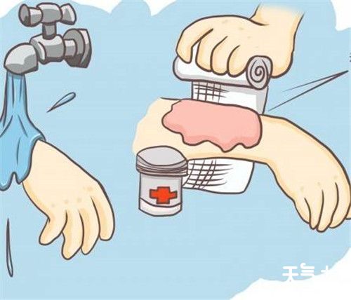 烫伤后处理方法，烫伤的家庭处理小妙招