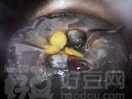 鱼头豆腐汤的做法步骤6