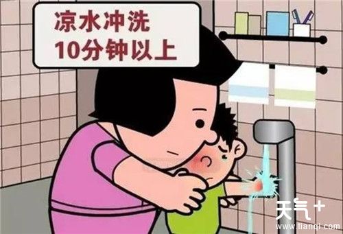 烫伤后处理方法，烫伤的家庭处理小妙招