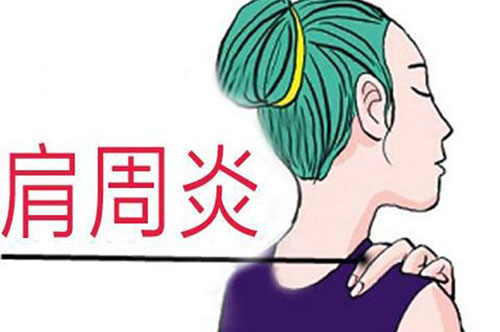 肩周炎能喝酒吗 关于肩周炎的4大误区
