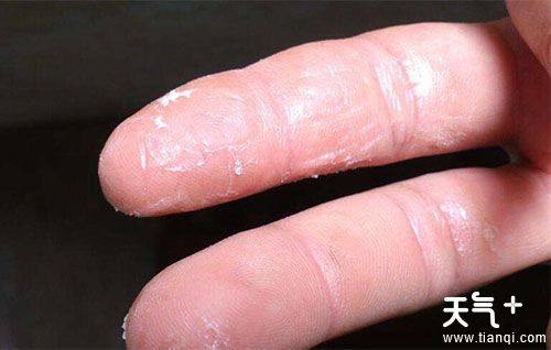 502胶水怎么洗掉,这里有最全的解决办法！