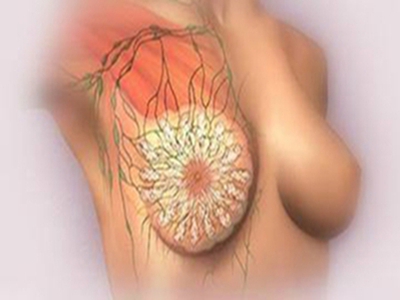 引起浆细胞性乳腺炎的原因有哪些