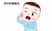 腮腺炎传染吗 流行性腮腺炎的预防