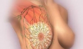 引起浆细胞性乳腺炎的原因有哪些