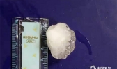 贵州多地遭遇冰雹袭击