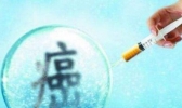 宫颈癌怎么检查