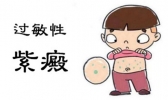 过敏性紫癜传染吗 过敏性紫癜的治疗